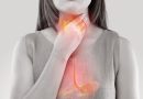 Alteraciones bucales asociadas a la enfermedad por reflujo gastroesofágico