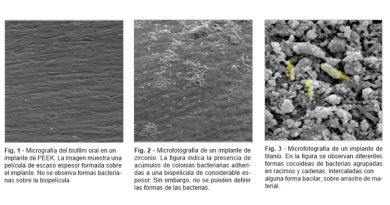 Biofilm Oral In vitro Sobre Tres Sustratos Diferentes: Titanio, Zirconio y Polieter-etercetona (Peek) Biofilm Oral In vitro Sobre Tres Sustratos Diferentes: Titanio, Zirconio y Polieter-etercetona (Peek)