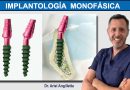 Implantología Monofásica