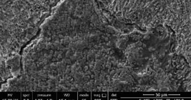 Análisis de la Microestructura del Esmalte Ante la Acción de Sistemas Adhesivos de Resina.