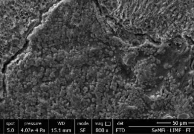 Análisis de la Microestructura del Esmalte Ante la Acción de Sistemas Adhesivos de Resina.